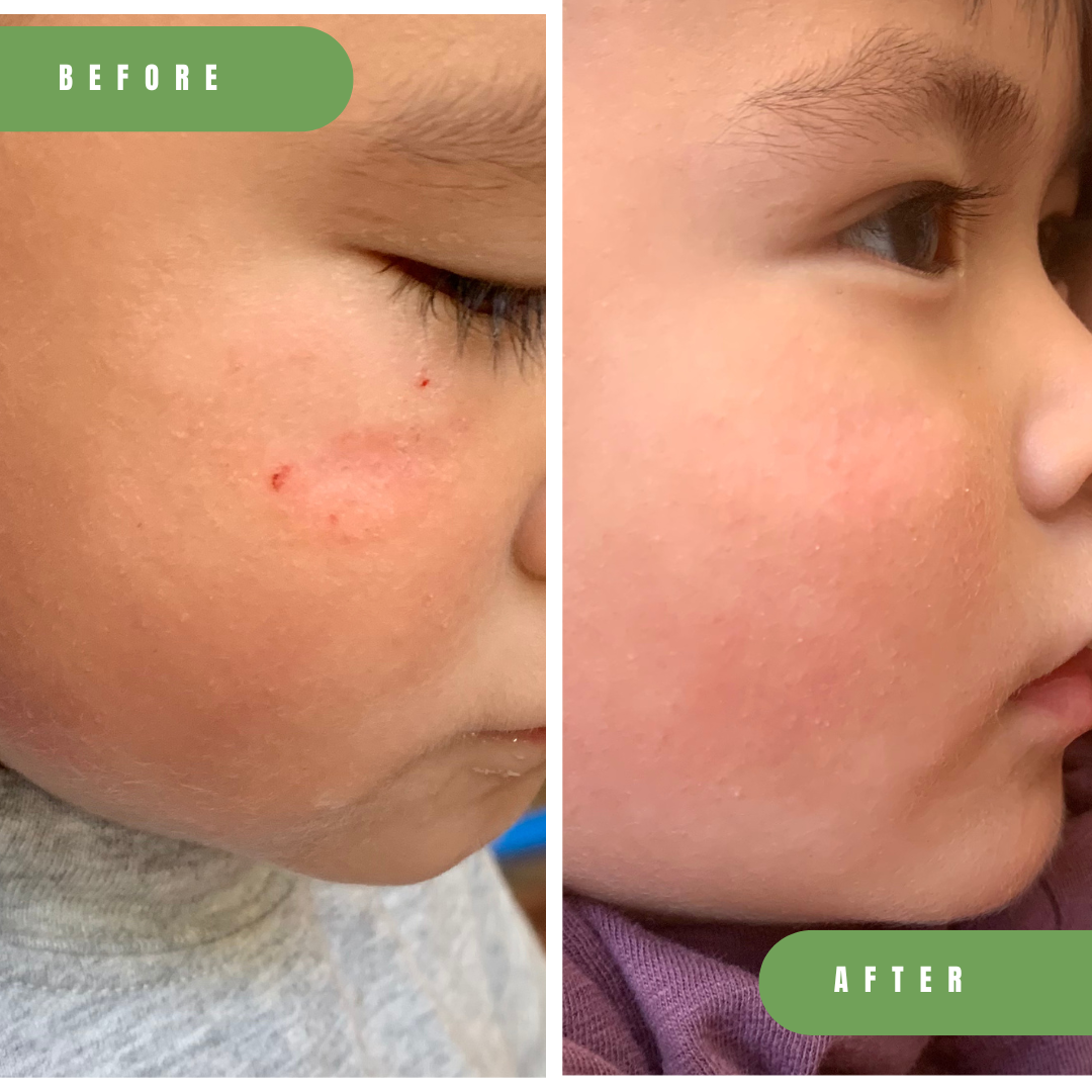 Tallow Balm Stick Spot Treatment